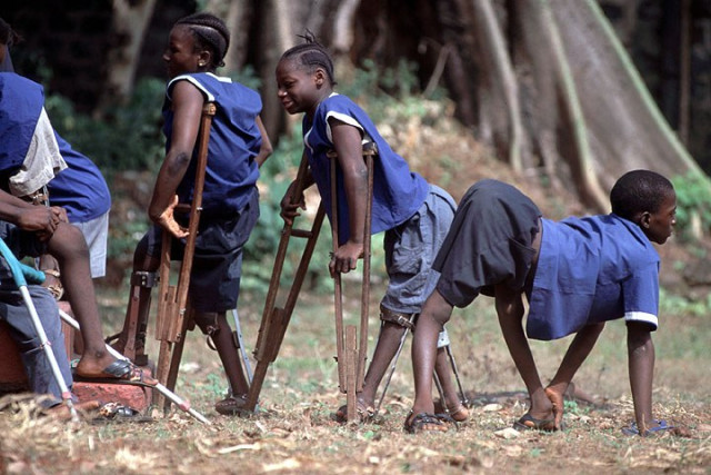 Children Affected by Polio